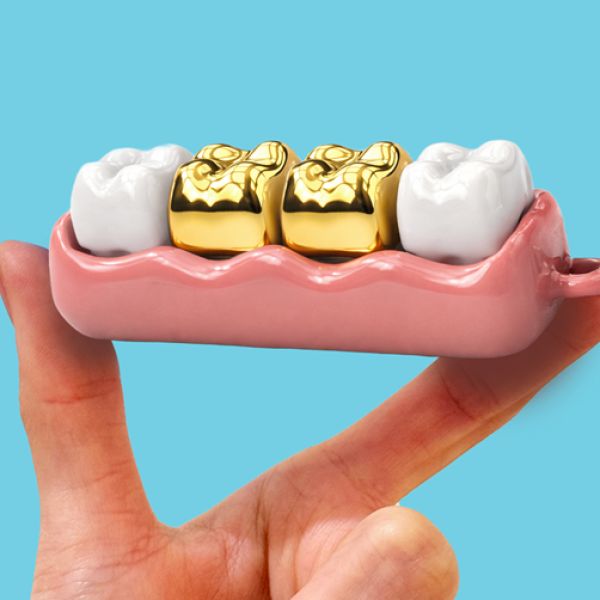 부천·경기·인천·서울 금형 사출 포트폴리오 - 치아 키캡 (플라스틱/실리콘 사출, 시제품·소량·대량 생산 사례)